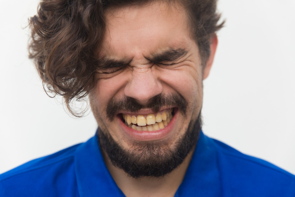 smoking stains on teeth​