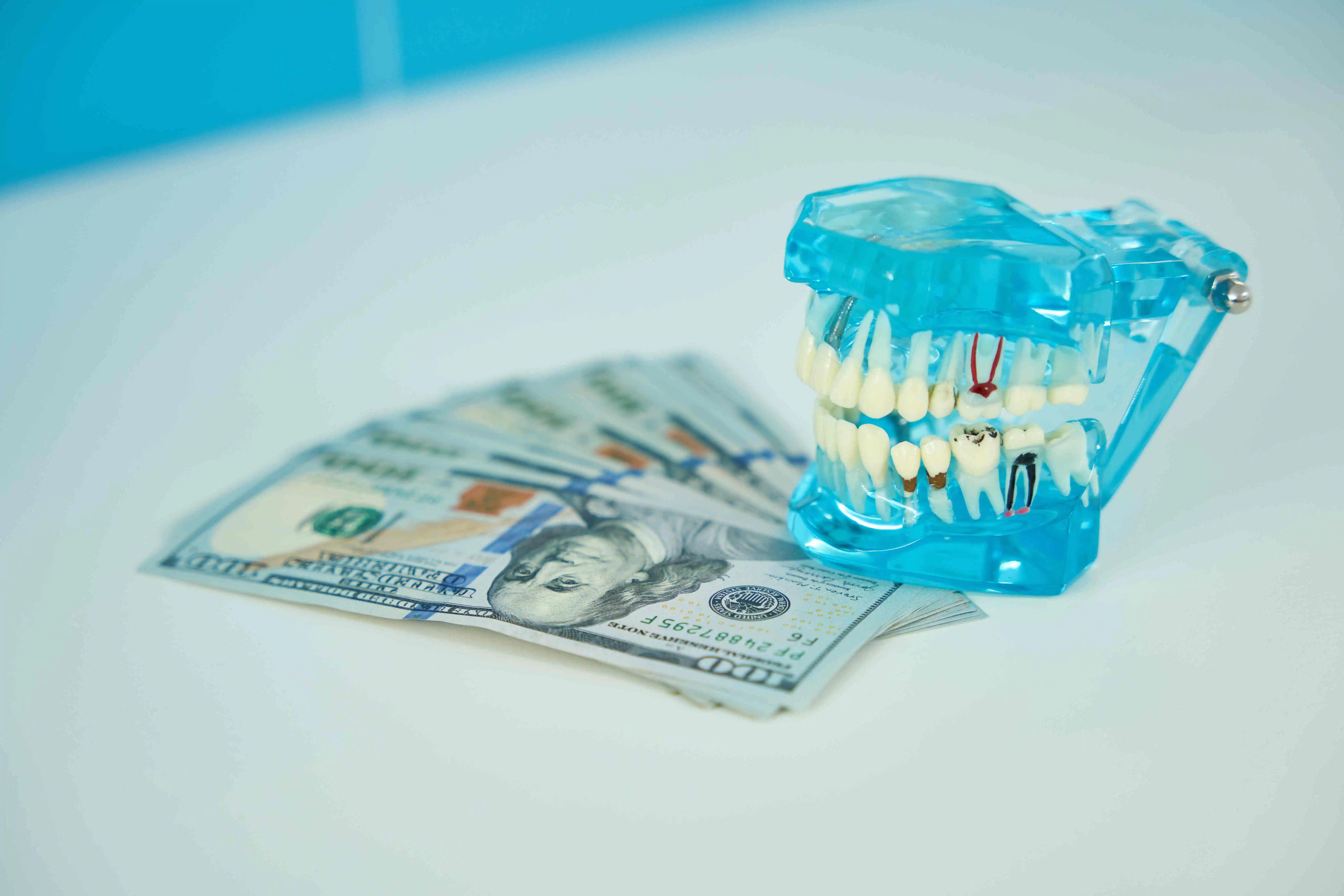 How Much Do Various Dental Crowns Cost?