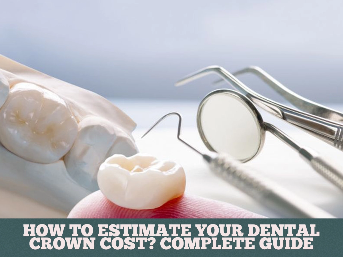 How to Estimate Your Dental Crown Cost? Complete Guide