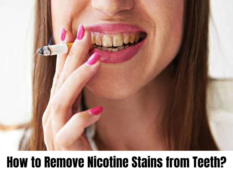 How to Remove Nicotine Stains from Teeth?