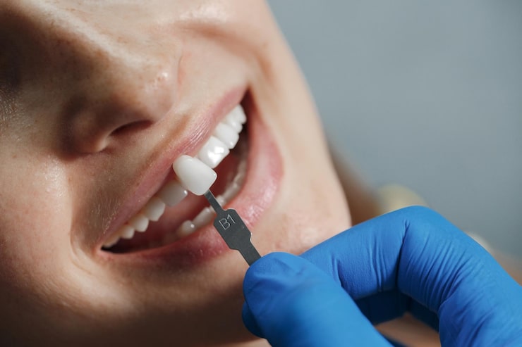 dental crown cost