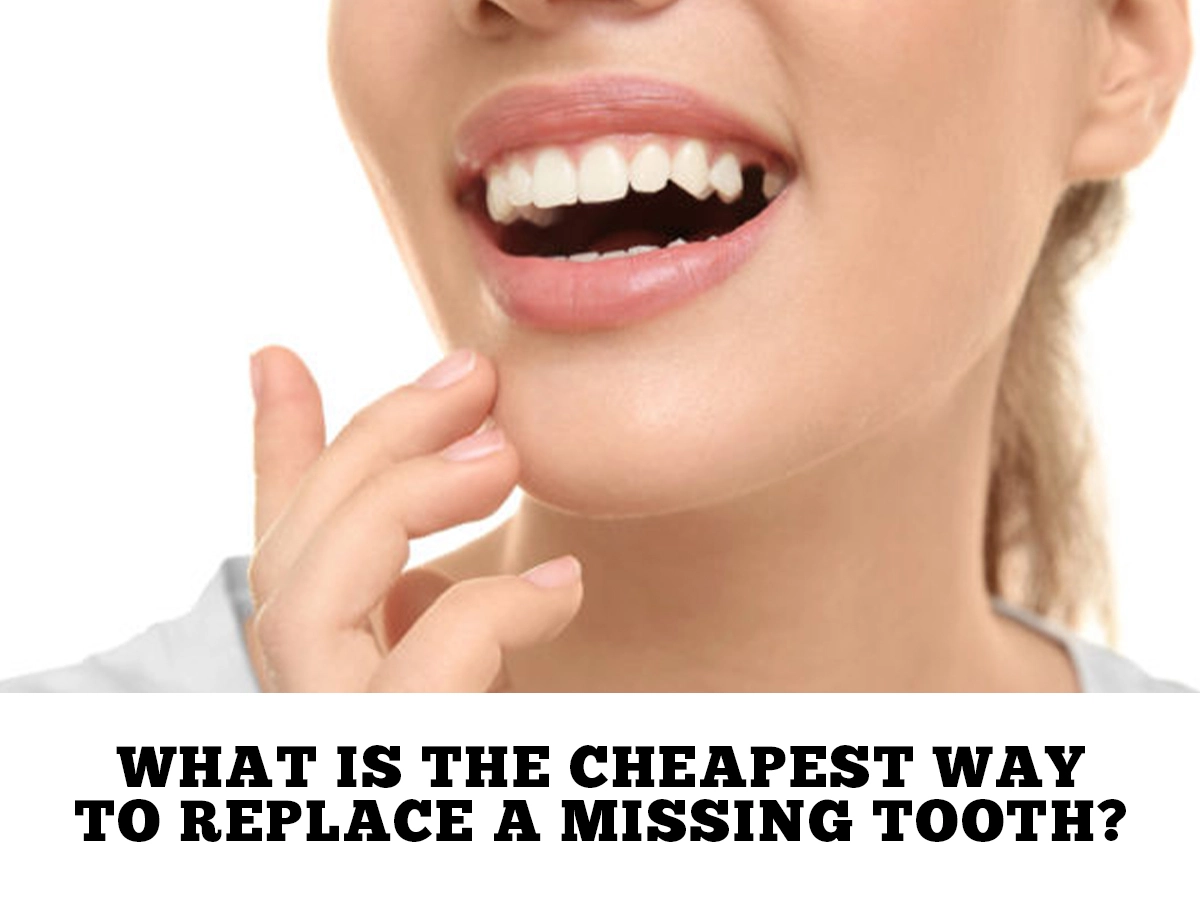 What is the Cheapest Way to Replace a Missing Tooth?