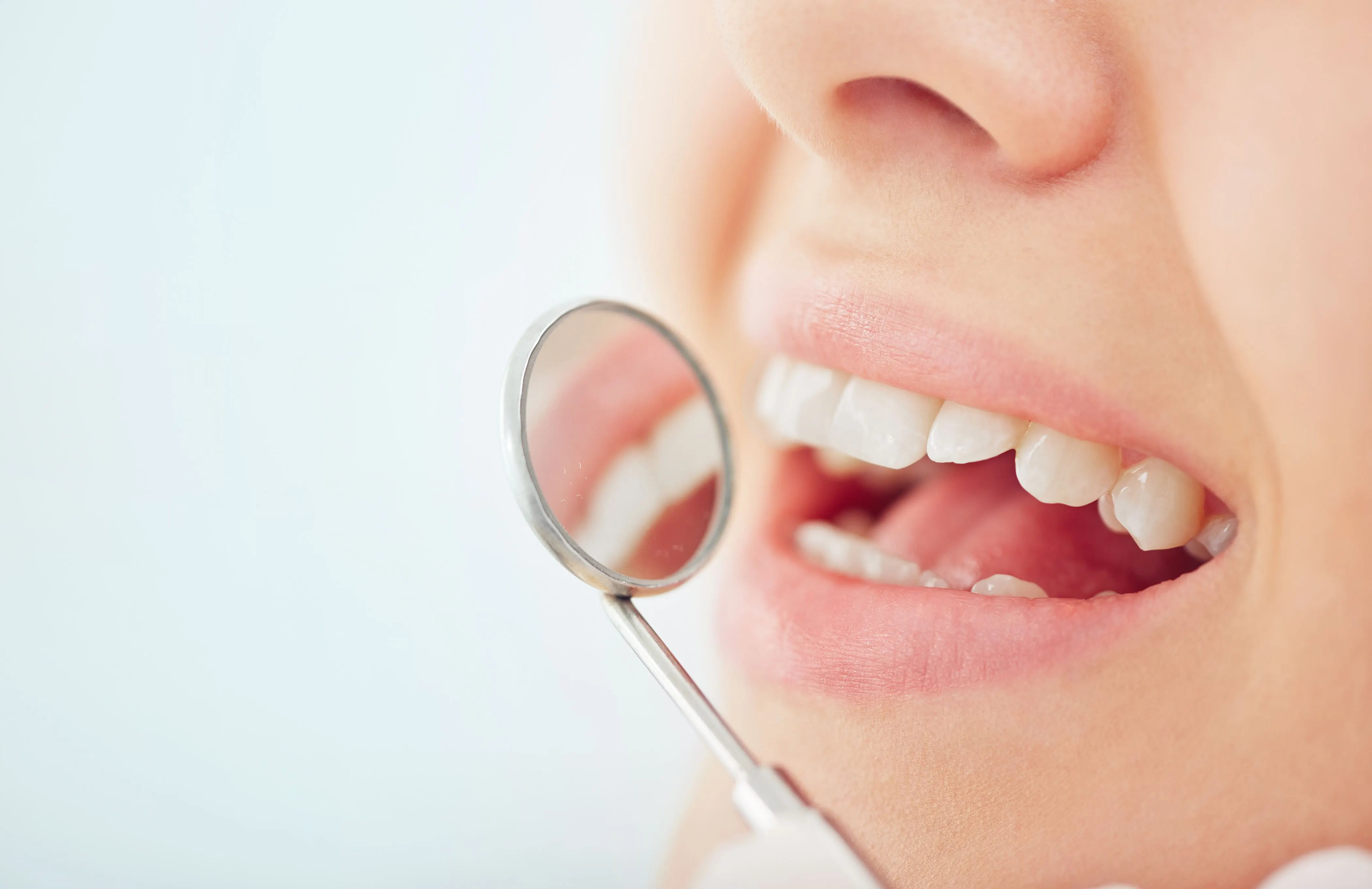 Does Coffee Stain Your Teeth - lady smiling in Dental Cleaning office