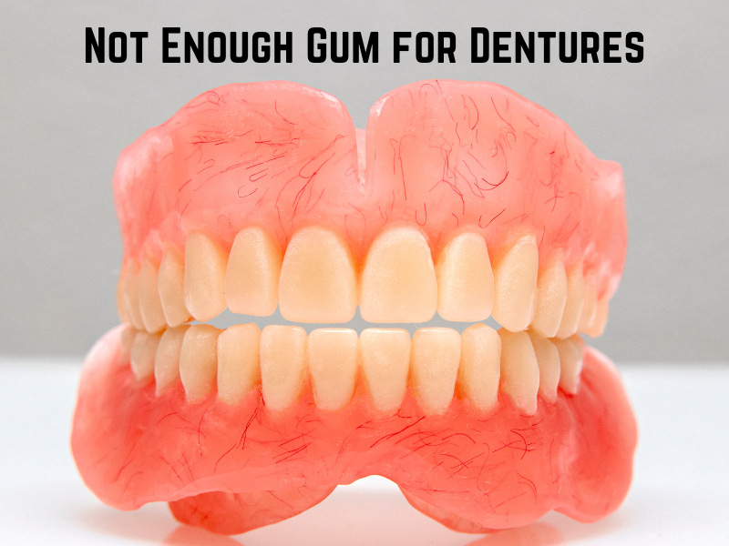 Not Enough Gum for Dentures