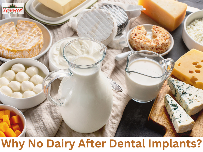 Why No Dairy After Dental Implants