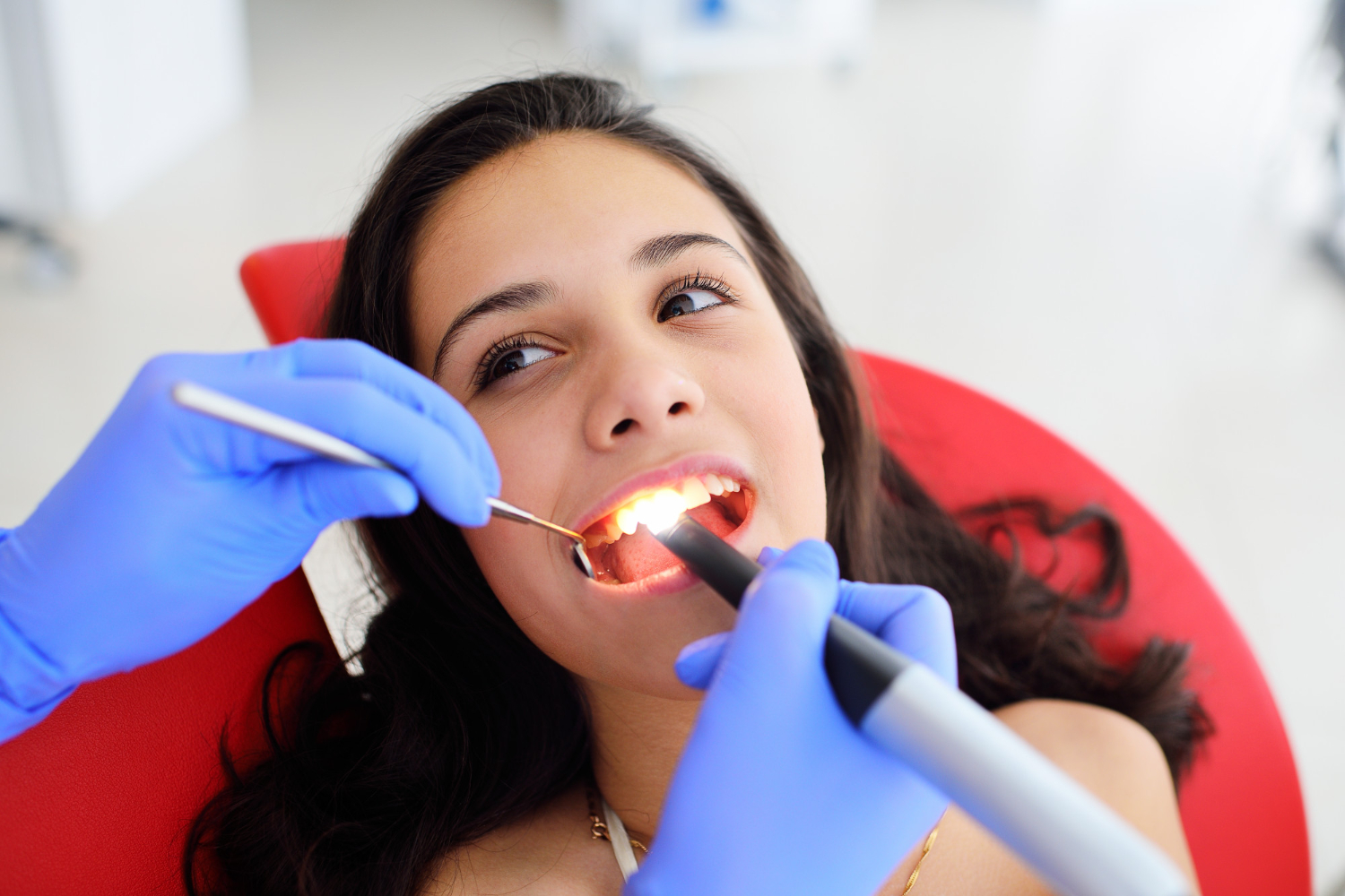 How Long Do Composite Fillings Last