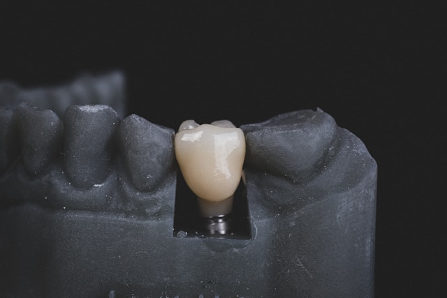 Tooth Implant 