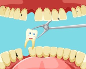 food after tooth extraction