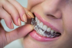 dentures vs implants
