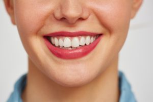 white spots on teeth