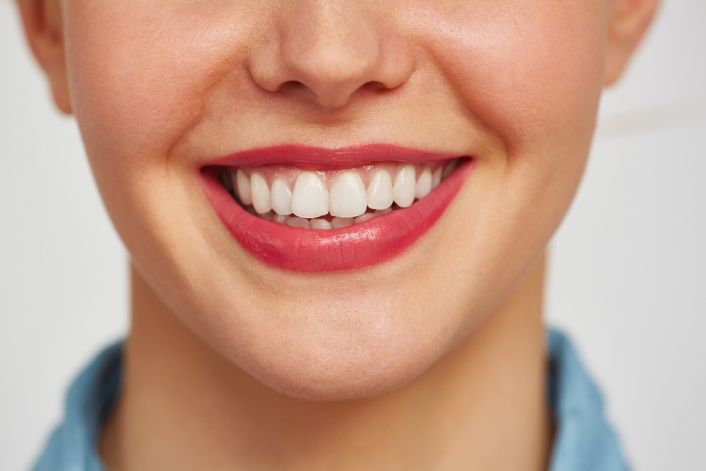 white spots on teeth