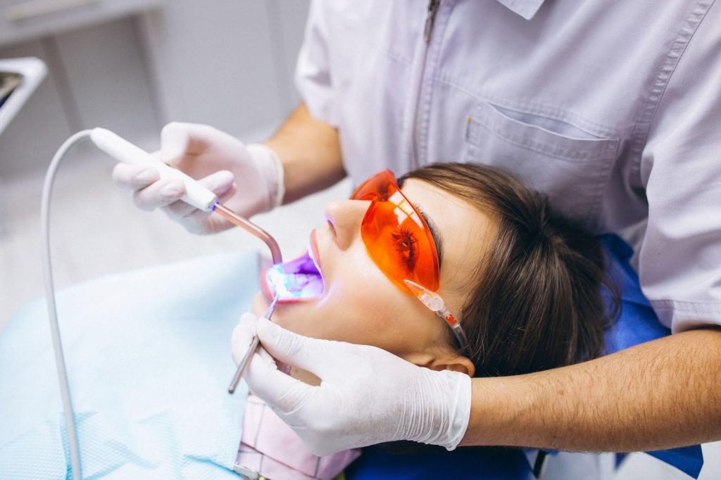 chipped tooth repair