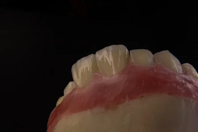 bridge dental procedure