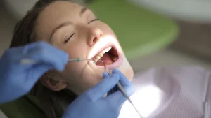 gum disease stages