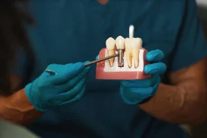 dental implants procedure